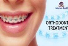 best orthodontist in Kolkata
